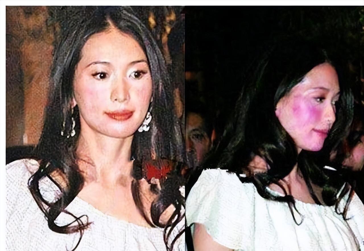 女明星生理缺陷_明星病痛_冯小刚白斑